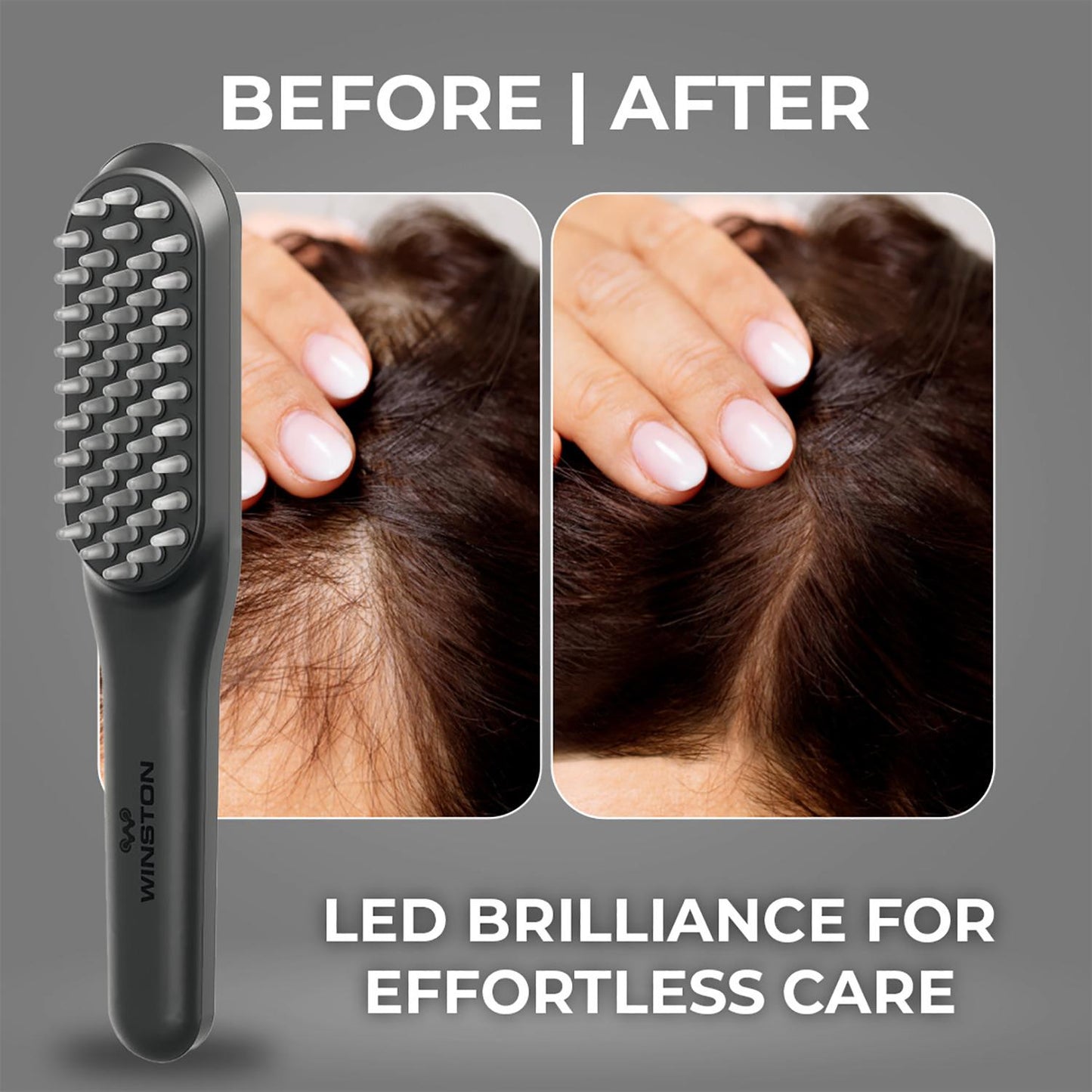 LED Hair Growth Therapy Comb