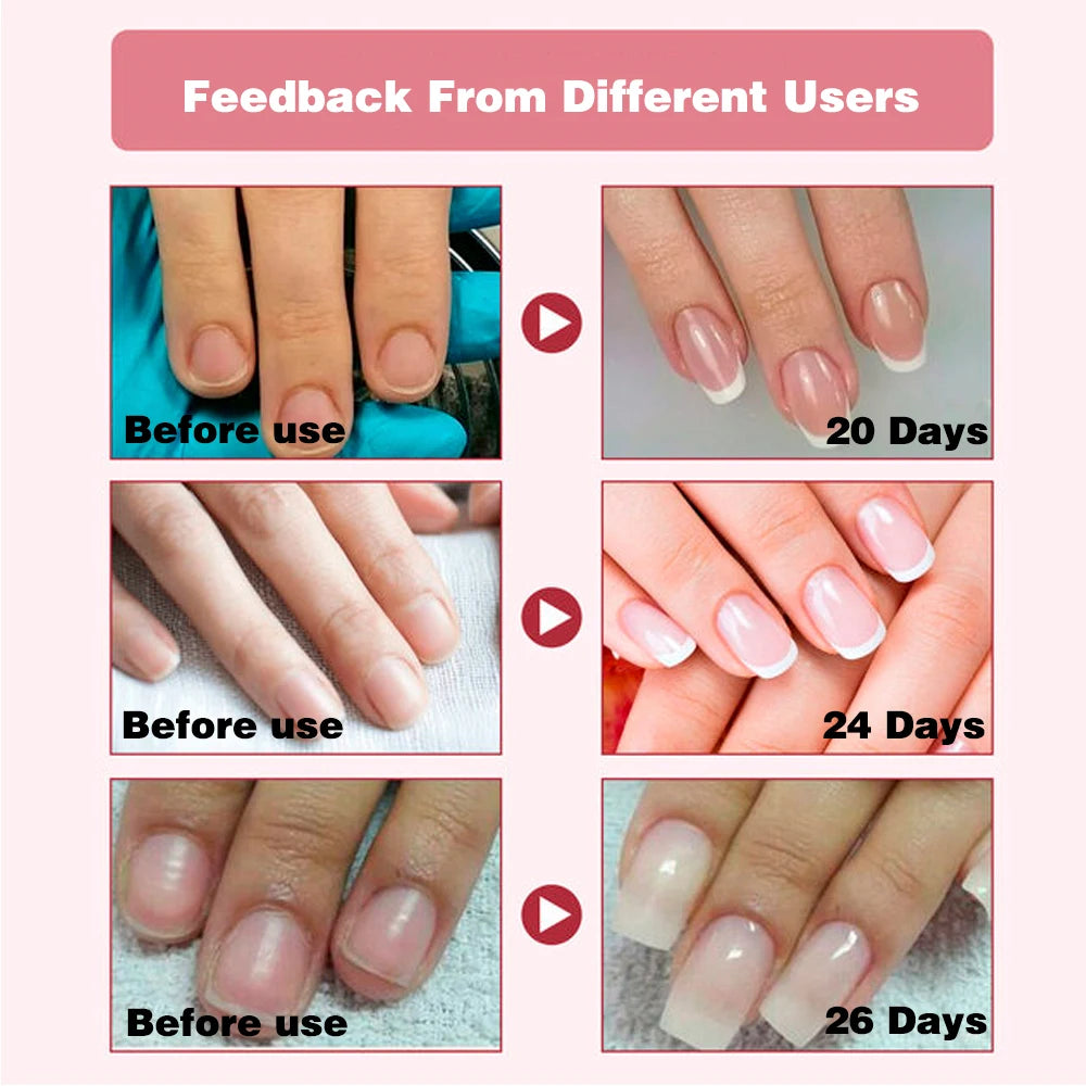 (BUY 2 GET 2 FREE) GEL Nail Strengthener Growth Restore Hardener Clear Nail Polish Base Coat Fast Dry 15ML Strong Repair Nail Art Treatment