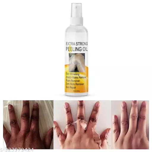 Extra Strong Yellow Peeling Oil for lightening the dark spots of all body parts